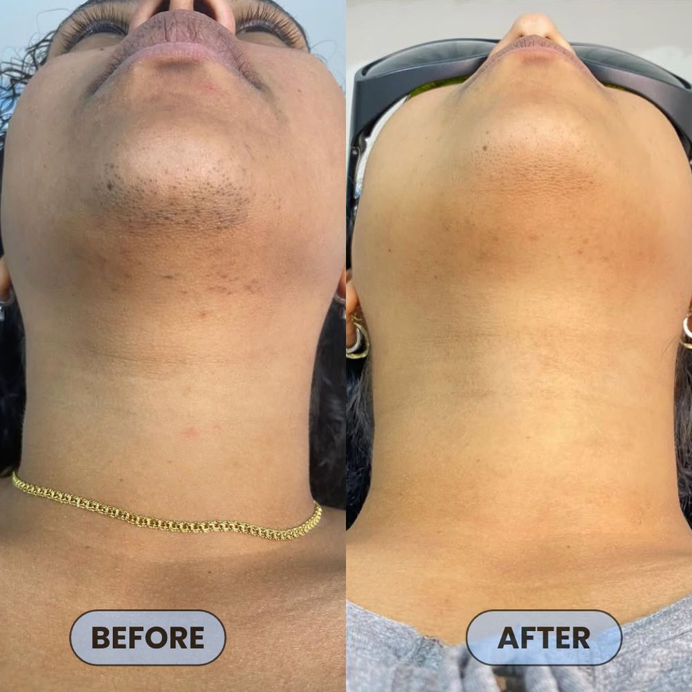<p>Users Share How #1 Bump Free Solution™ Changed Their Skin</p>