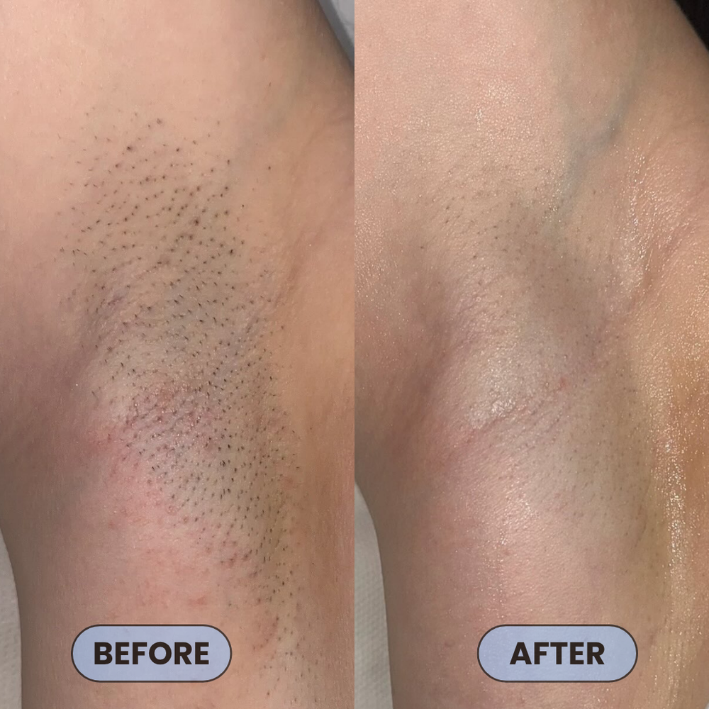 <p>Users Share How #1 Bump Free Solution™ Changed Their Skin</p>