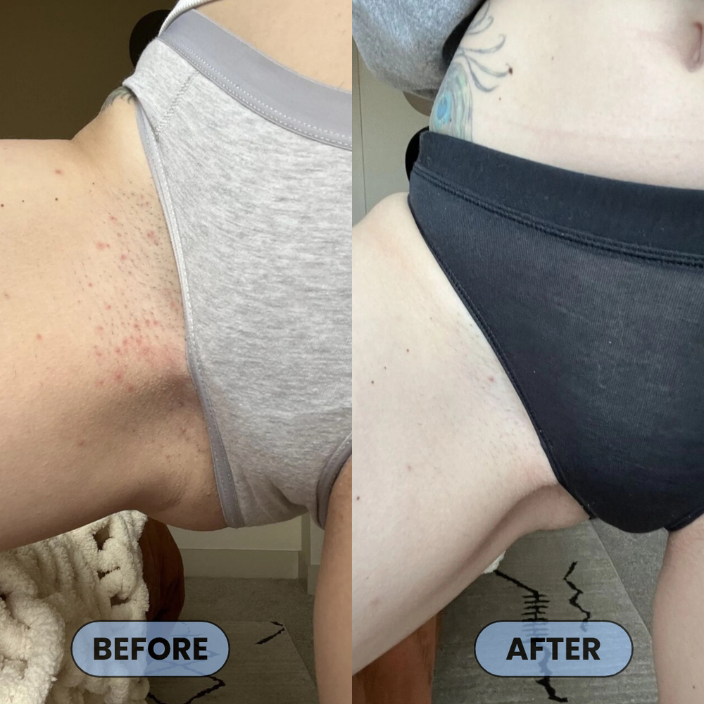 <p>Users Share How #1 Bump Free Solution™ Changed Their Skin</p>