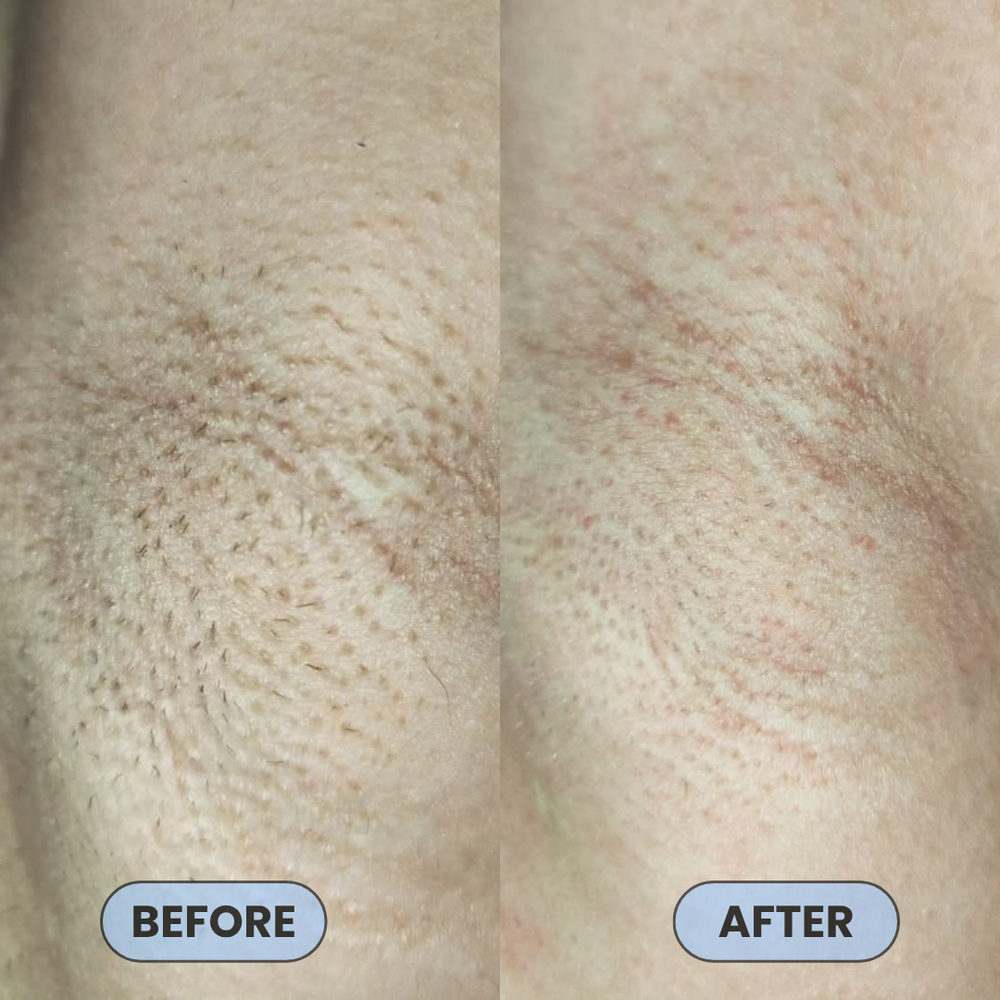 <p>Users Share How #1 Bump Free Solution™ Changed Their Skin</p>