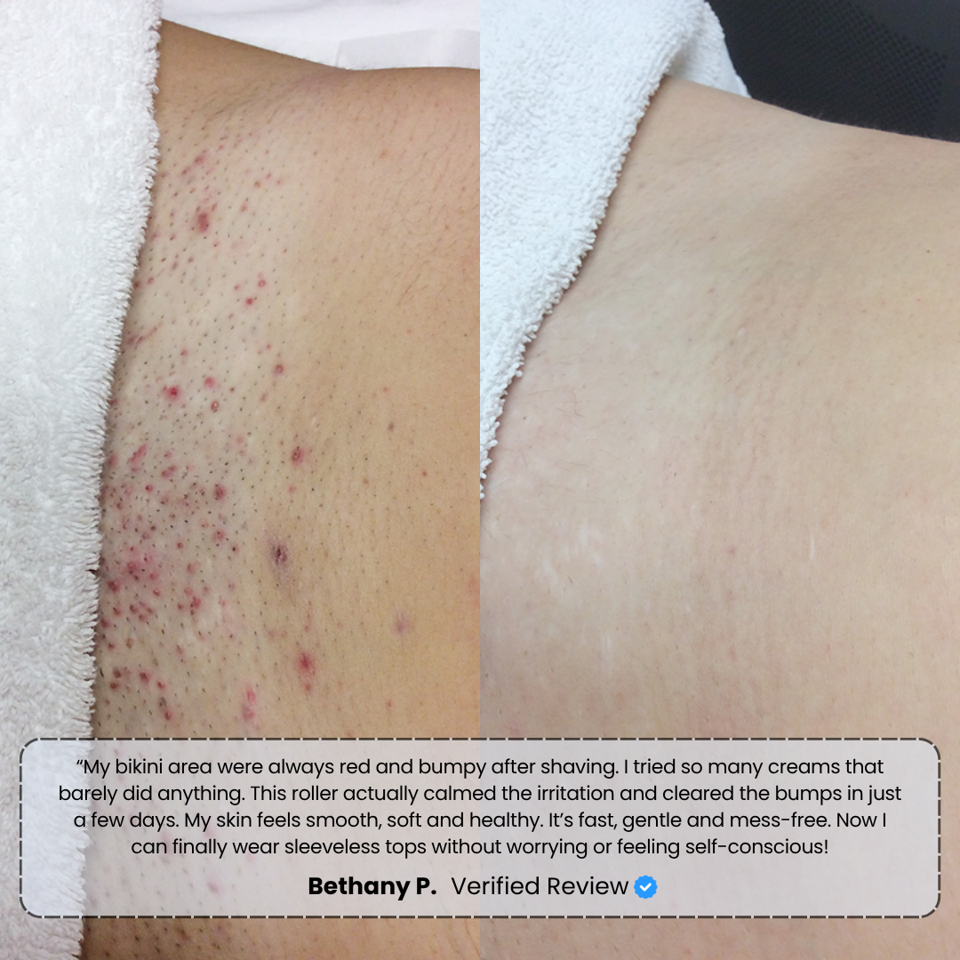 #1 Bump Free Solution™