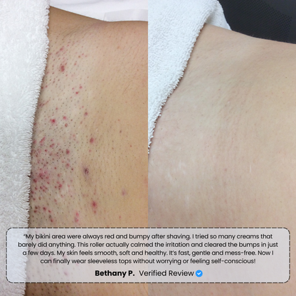 #1 Bump Free Solution™
