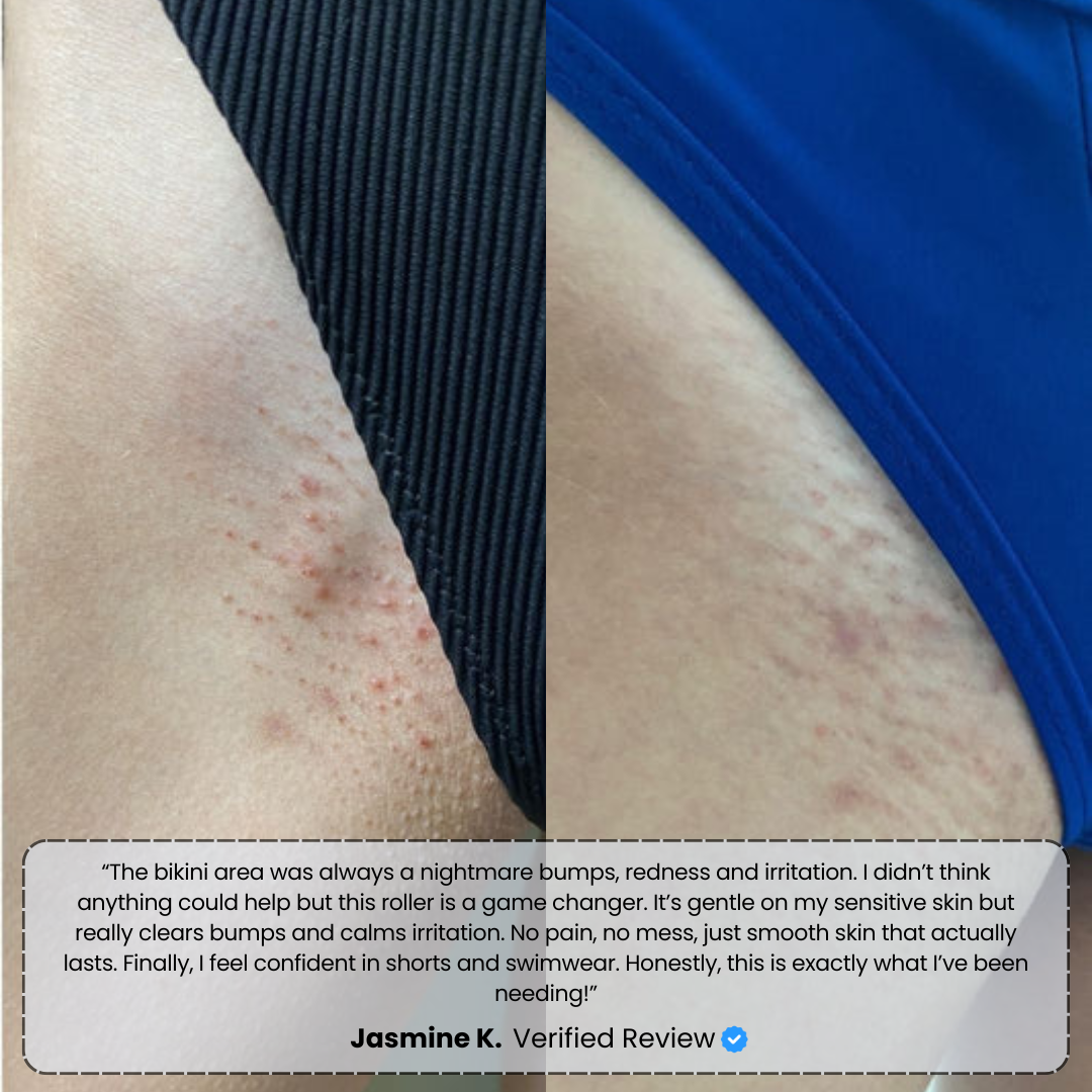 #1 Bump Free Solution™