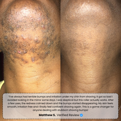 #1 Bump Free Solution™